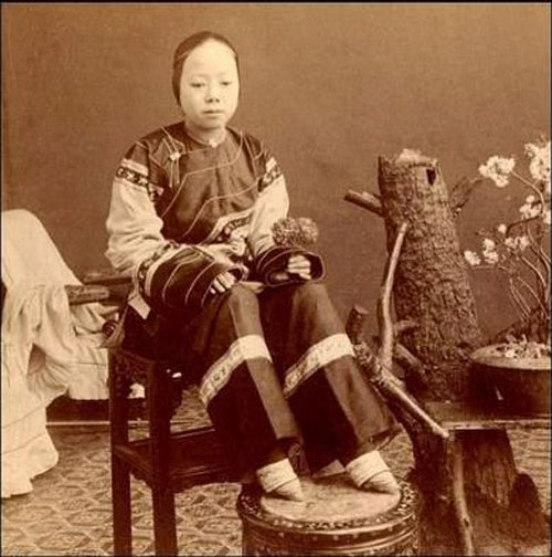 10 kiểu giày kỳ quái trong lịch sử thời trang - 19