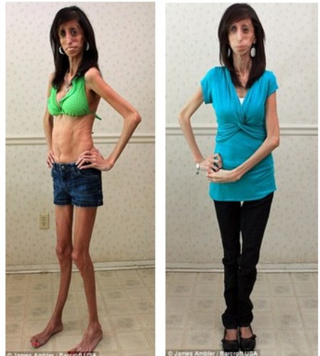 Lizzie Velasquez truyền cảm hứng