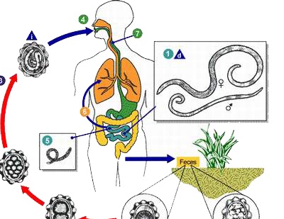 bệnh ký sinh trùng đường ruột