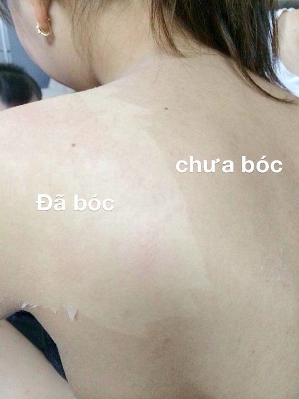 tắm trắng nguy hiểm