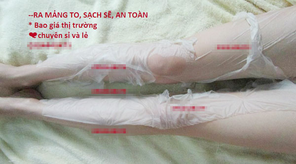 tắm trắng nguy hiểm