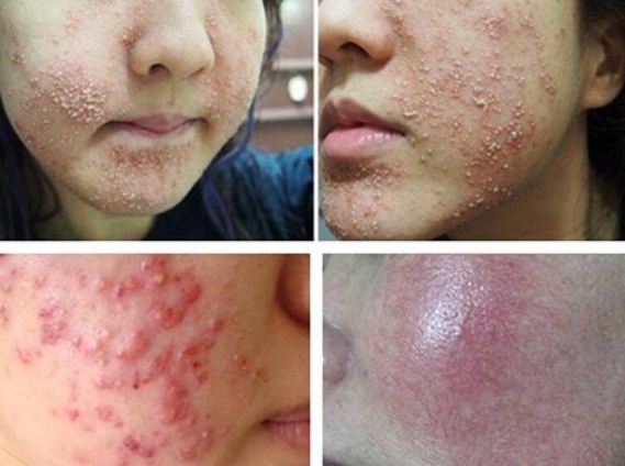 mỹ phẩm làm trắng da cấp tốc