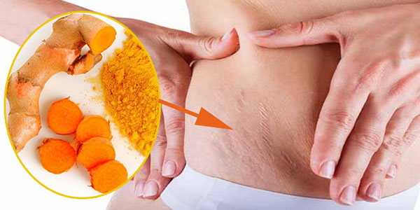 trị rạn da với nghệ
